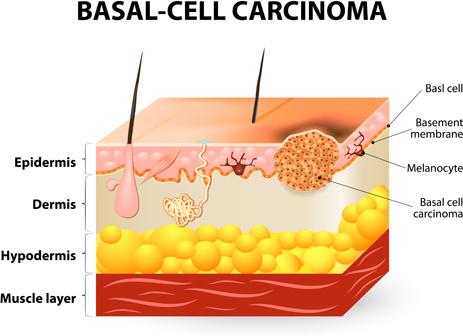 skin structure diagram vectors