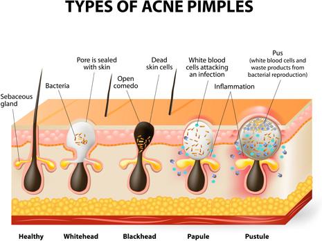 skin structure diagram vectors