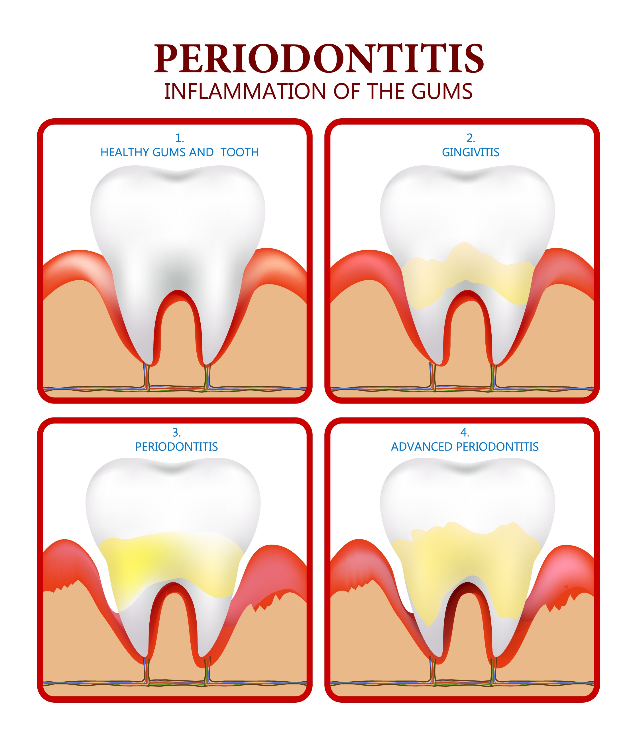 periodontics poster flat colored design tooth icons